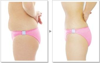 您在武漢協(xié)和醫(yī)院可以找到熱瑪吉嗎？預(yù)約技術(shù)嫻熟的醫(yī)生，口碑非常好！