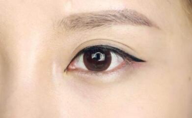 上海九院美容科的專家揭秘！魏皎、張余光、韋敏醫(yī)生值得信賴嗎？附磨顴骨體驗(yàn)分享