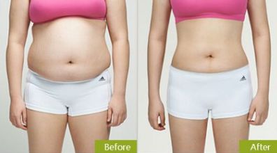 合肥祛眼袋，如何選擇最適合的醫(yī)院？