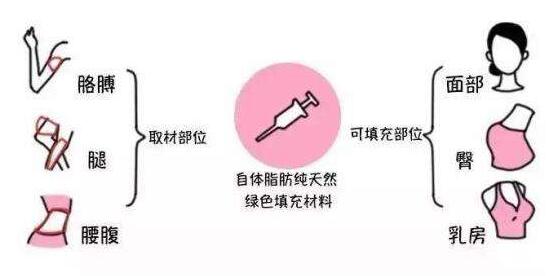 成都潘紅偉吸脂手術(shù)效果如何？專家解讀！