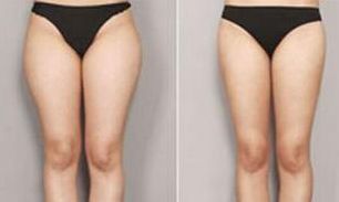 合肥祛痘效果最好的醫(yī)療美容機(jī)構(gòu)有哪些？