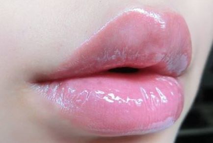 西寧哪家醫(yī)院的雙眼皮效果好？