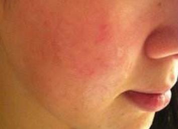 揭秘鄭州五位頗具盛名的鼻子專家，治療技術(shù)獨具匠心，深受人們推崇！