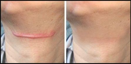 南京哪家私密醫(yī)院做得最好？來一探究竟！