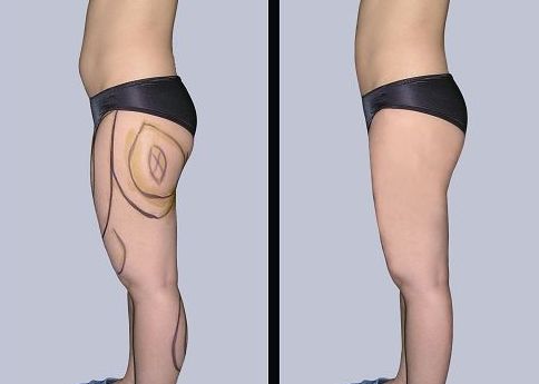 合肥哪家醫(yī)院可以有效治療腋臭問(wèn)題？