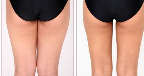 桂林私立醫(yī)院推薦，哪家好？2023最新排名解析