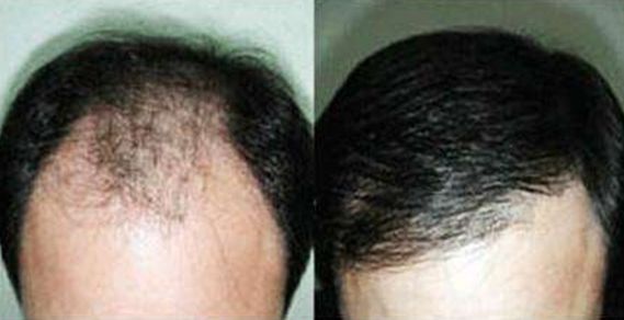 大連去狐臭哪家醫(yī)院效果好，專家推薦的醫(yī)院有哪些？