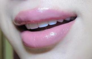 2023無錫嗨體祛眼周細(xì)紋前十名專家排名(宋明義、周展超、施浩然實(shí)力遙遙領(lǐng)先，列前三)