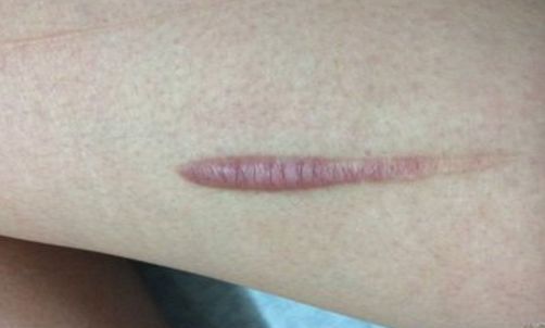 【2023年揚州雙眼皮正規(guī)醫(yī)院排行榜公布！最靠譜的哪家好？】