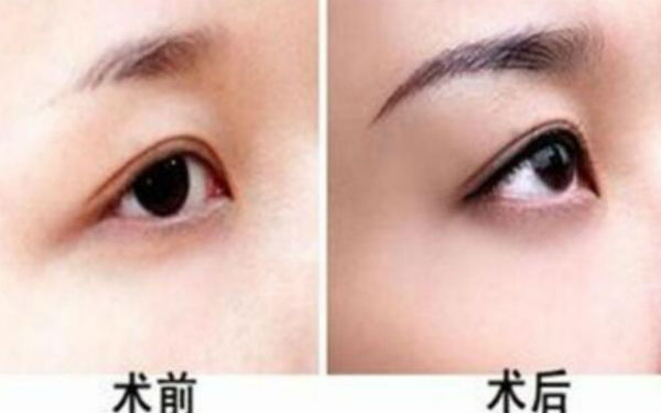 西京醫(yī)院超贊整形醫(yī)生與驚人隆鼻案例，受歡迎至極！