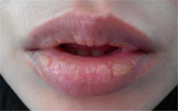 2023蘇州微創(chuàng)印第安紋排行前十位的醫(yī)生(浦彥、丁云莎、單夢琳醫(yī)生大咖實(shí)力認(rèn)證)