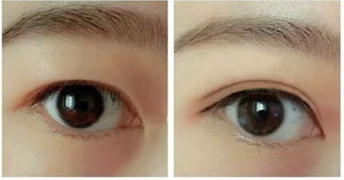 南昌做隆胸手術(shù)哪家好？選南昌最受歡迎的隆胸手術(shù)醫(yī)院有哪些