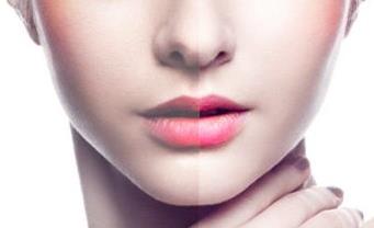 2023泰安玻尿酸去深皺紋醫(yī)生口碑榜前十強(qiáng)(王東陽(yáng)、隨永銘、李愛華實(shí)力口碑值得期待！)