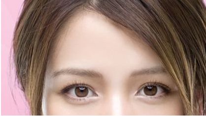 沈陽哪家醫(yī)院的雙眼皮修復效果好？