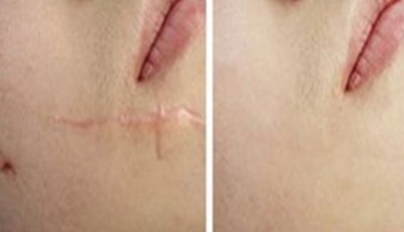 上海有哪些整形醫(yī)院值得推薦呢？