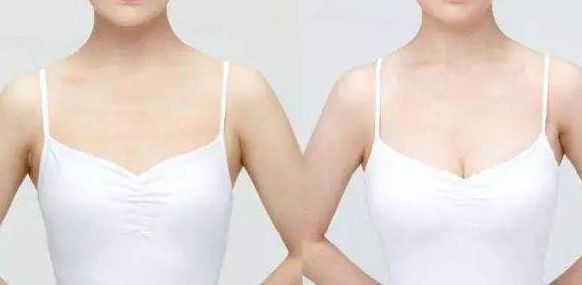 威海假體豐胸醫(yī)院哪家好？從專家口碑、手術(shù)效果看威海頂級醫(yī)院推薦！