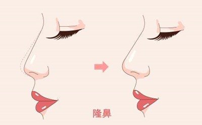 2023重慶膠原蛋白填充面部強(qiáng)榜前10名的專(zhuān)家(陳鵬、楊藝、蔣思軍這幾家技術(shù)高超價(jià)格低)