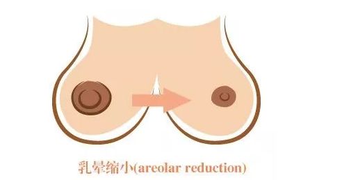 長(zhǎng)沙激光美容醫(yī)院哪家好？探尋長(zhǎng)沙地區(qū)激光美容行業(yè)領(lǐng)軍者