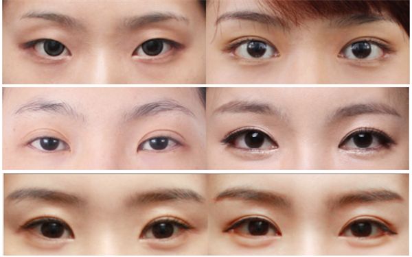 福州埋線減肥醫(yī)院哪家好？了解福州埋線減肥醫(yī)院的專業(yè)優(yōu)勢和患者評價