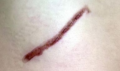 云南青少年減肥哪家好？探索云南地區(qū)青少年瘦身好方法