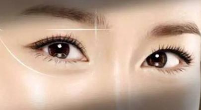 2023長沙假體復(fù)合隆胸評分前10強(qiáng)專家(姚志文、龍劍虹、肖莎莎獲好評)