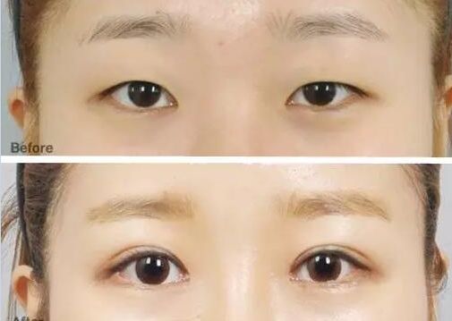 成都眼科醫(yī)院眼睛縫針技術如何？排名靠前的醫(yī)院有哪些？