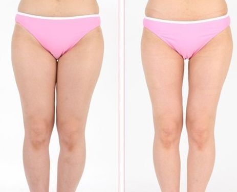 株洲祛痘哪家醫(yī)院靠譜？探尋株洲專業(yè)祛痘醫(yī)療機(jī)構(gòu)！