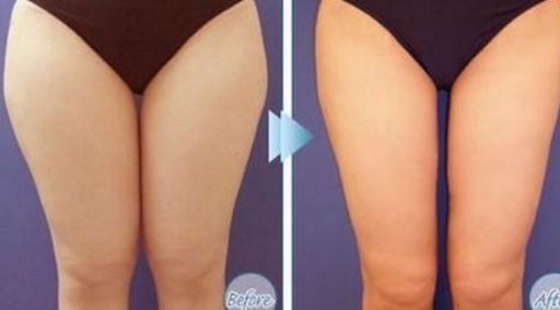 南大學(xué)湘雅醫(yī)學(xué)院的醫(yī)生生平及價(jià)格表如何？