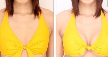 李健寧顱面裂畸形修復(fù)效果如何？想了解的人快來看！