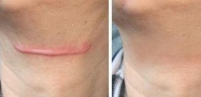 上海哪家醫(yī)院治療皮膚色素斑好？