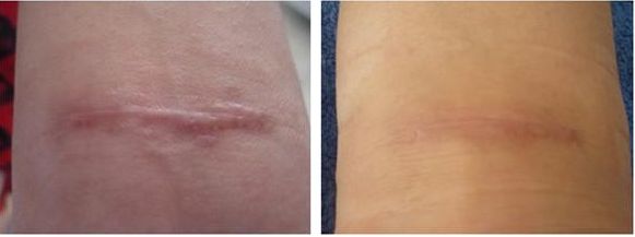 大連哪家眼科醫(yī)院提供修復(fù)外眼角最好的服務(wù)？