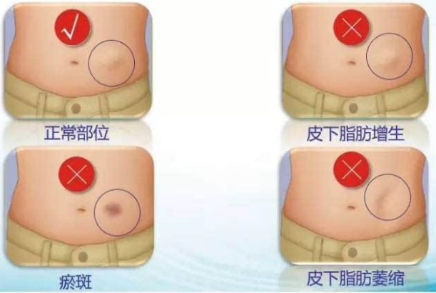 哈爾濱整形醫(yī)院哪家好？選擇哈爾濱整容醫(yī)院前必知的五大關鍵點