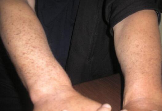 上海九院陳文杰醫(yī)生詳細(xì)介紹及成功案例分享