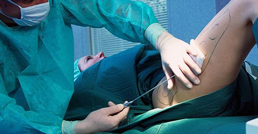 廣州美容整形醫(yī)院哪家好？推薦2023年評(píng)選的廣州頂尖美容整形醫(yī)院