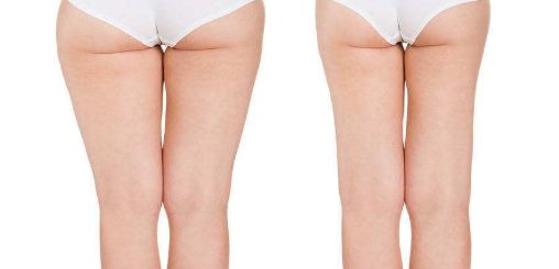 2023年西寧最受推薦的醫(yī)院紅血絲治療服務是哪家？