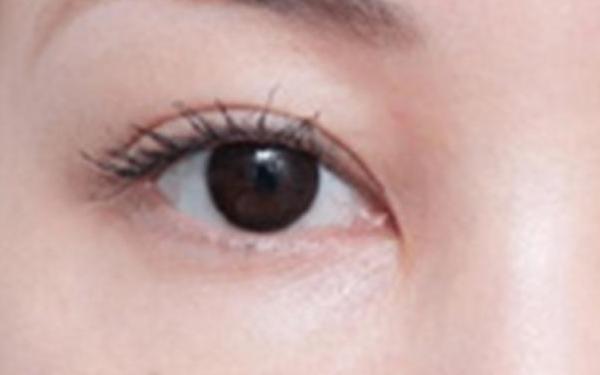 廣州哪家醫(yī)院做隆胸手術(shù)技術(shù)高？醫(yī)生資深經(jīng)驗(yàn)來(lái)看詳細(xì)介紹！