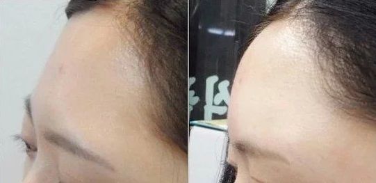 沈陽(yáng)私密整形去哪家好？專家推薦排行榜2023