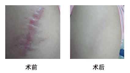 2023淮北光子點痣專家評價前十強(劉家賀、方芹、任學東內(nèi)行直呼)