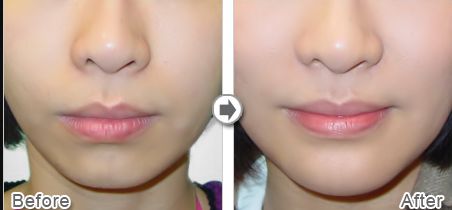 上海做雙眼皮哪家好醫(yī)院？專家評選2023年最佳雙眼皮醫(yī)院