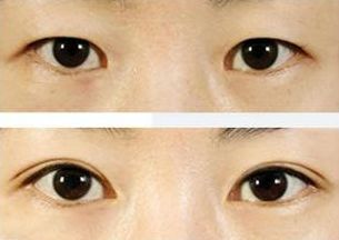 上海治療青春痘的專家推薦，哪家醫(yī)院效果最佳？