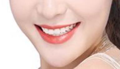 2023廈門(mén)電動(dòng)負(fù)壓吸脂去雙下巴專家前10榜單(袁靜明、周璟、張俠網(wǎng)友親測(cè)好評(píng)名單分享！)