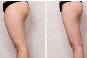 唐山哪家醫(yī)院整形科好？專家推薦，匯總唐山當(dāng)?shù)乜诒罴颜吾t(yī)院