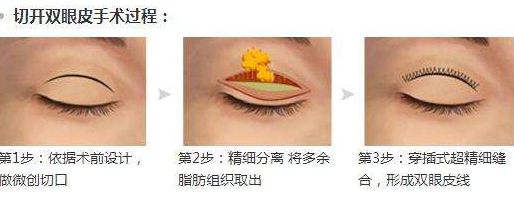 淮安光子嫩膚醫(yī)院哪家好？專家為您推薦5家權(quán)威醫(yī)院