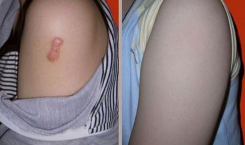 深圳隆下巴哪家醫(yī)院好？如何選擇合適的下巴整形醫(yī)院？