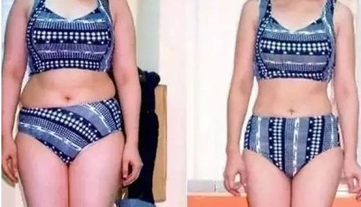 上海哪家醫(yī)院有最有效的黑眼圈去除治療？