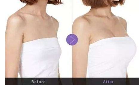 山東滕州哪家整形醫(yī)院好？解讀滕州市整形醫(yī)院排行榜及主要醫(yī)院介紹