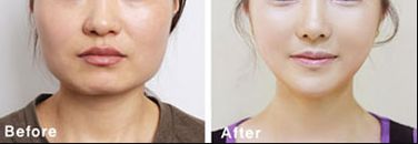 南昌熱瑪吉哪家醫(yī)院做得好？專業(yè)推薦南昌市xx醫(yī)院