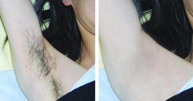 成都整下巴哪家醫(yī)院好，專家助你實現(xiàn)完美下巴線條