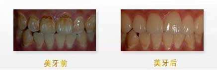 揭秘：武漢眼科醫(yī)生，他們的技術(shù)無人能敵！