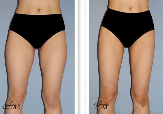 福州哪家整形醫(yī)院做下巴好？多年經(jīng)驗(yàn)專業(yè)醫(yī)生為您解答！